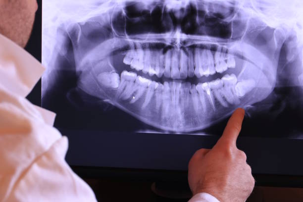 Best Emergency Treatment for Toothache in Chester, MD