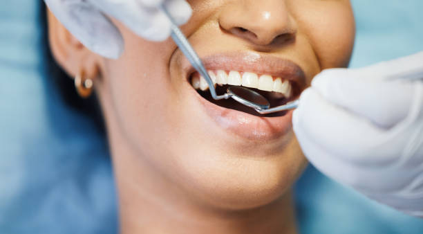 Best Emergency Broken Tooth Repair in Chester, MD