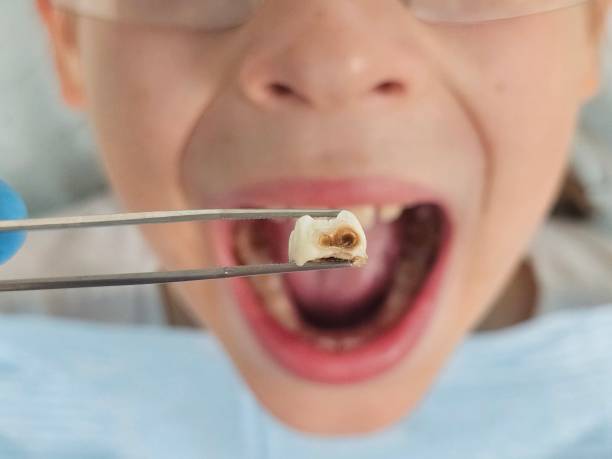 Best Weekend Emergency Dentist in Chester, MD
