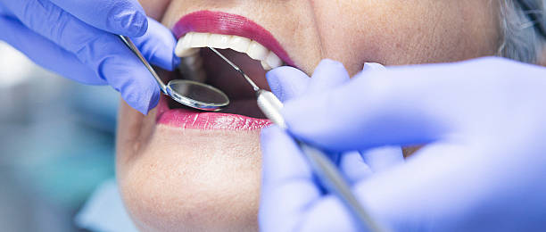 Best Emergency Treatment for Toothache in Chester, MD